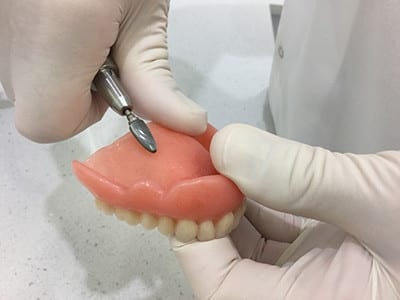 Denture Relines in Melbourne