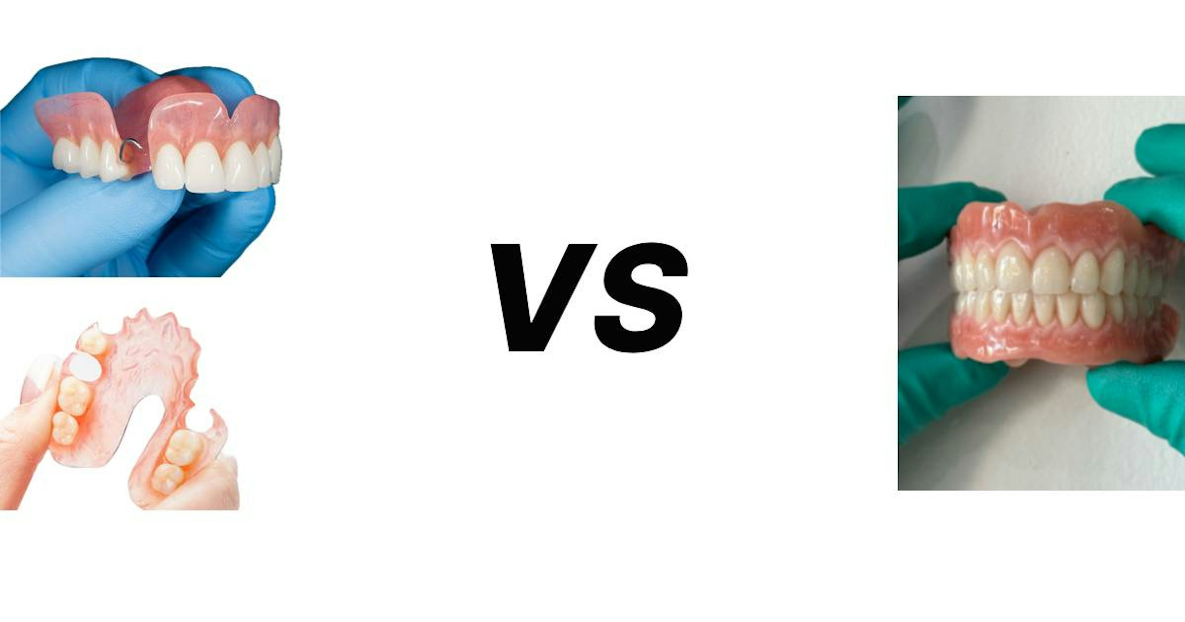 Comparison of full and partial dentures on dental model