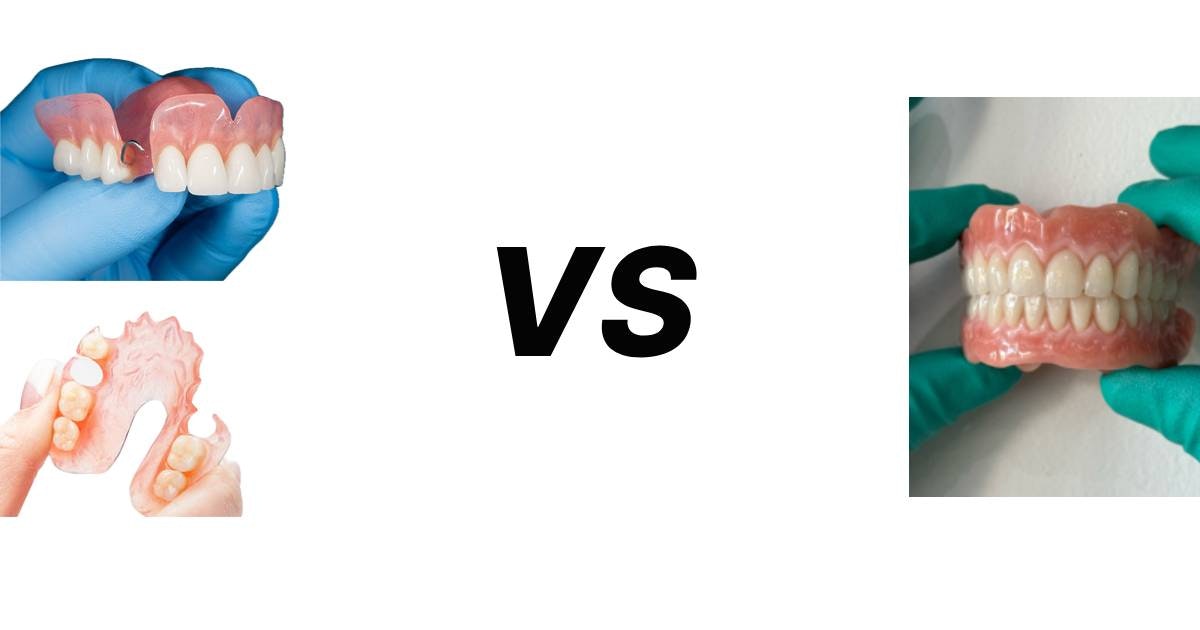Comparison of full and partial dentures on dental model